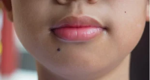 चेहरे के तिल में छुपा है किस्मत का राज, अनदेखी पड़ सकती है भारी