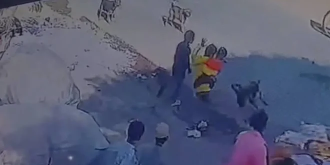 लातूर में आवारा कुत्तों का कहर: 4 घंटे में डॉक्टर समेत 35 लोग घायल, दो साल के मासूम का होंठ बुरी तरह जख्मी