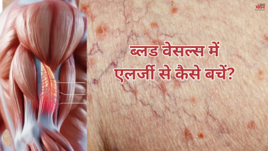 Photo of हेल्थ टिप्स: सर्दियों में क्यों होती है ब्लड वेसल्स में एलर्जी, ये है बचाव और इलाज