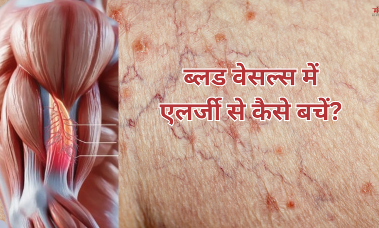 ब्लड वेसल्स में एलर्जी