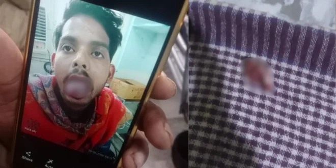 गाजियाबाद में खौफनाक वारदात: पत्नी ने चाकू से काट दी पति की जीभ, एक साल पहले हुई थी शादी
