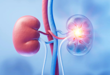 Photo of शरीर में होने वाले इन लक्षणों को न करें इग्नोर, हो सकते हैं किडनी खराब होने के शुरुआती संकेत