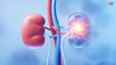 Photo of शरीर में होने वाले इन लक्षणों को न करें इग्नोर, हो सकते हैं किडनी खराब होने के शुरुआती संकेत