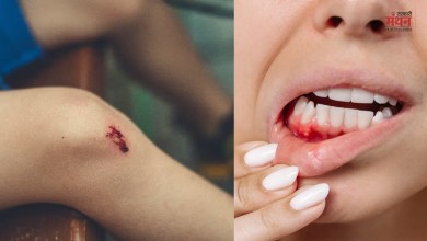 Photo of मसूड़ों से खून और नीले निशान को न करें नजरंदाज, शरीर में विटामिन K की कमी का है संकेत