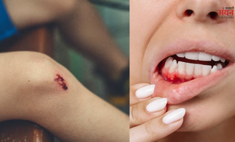 विटामिन