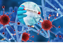 Photo of इन छोटे-छोटे बदलावों को न करें नजरंदाज, हो सकते हैं कैंसर के संकेत