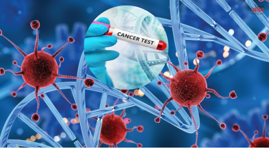 Photo of इन छोटे-छोटे बदलावों को न करें नजरंदाज, हो सकते हैं कैंसर के संकेत