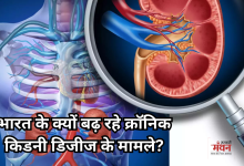 Photo of क्रॉनिक किडनी डिजीज का शिकार हो रहे युवा, बचने के लिए अपनाएं से आदतें