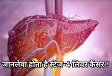Photo of कितना घातक है स्टेज-4 लिवर कैंसर और क्यों असंभव है इलाज?, यहां जानें बचने के तरीके और शुरूआती लक्षण