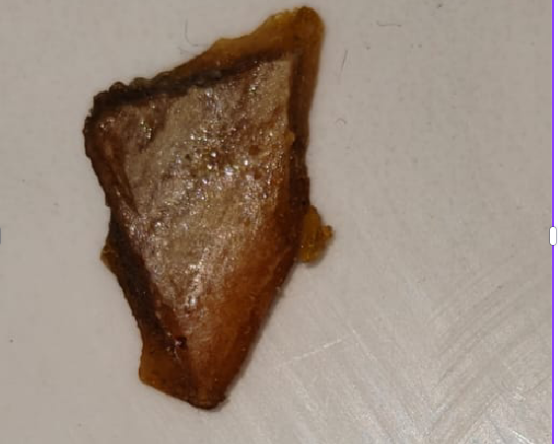 मांस का टुकड़ा