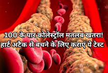 Photo of सावधान! बदल गया है कोलेस्ट्रॉल का सेफ लेवल, अब 100 के पार गया LDL, तो बढ़ जाएगा हार्ट अटैक का खतरा