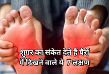 Photo of पैरों का रंग और जलन भी है डायबिटीज का संकेत, न करें नजरंदाज, डॉक्टर से लें सलाह