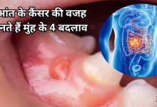 Photo of मसूड़ों से खून और सांसों की बदबू को न लें हल्के में, हो सकते हैं कैंसर के शुरुआती संकेत