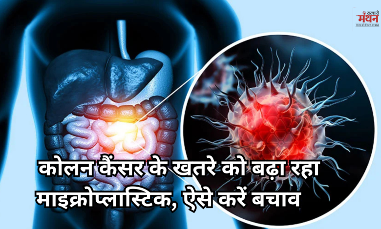 कोलन कैंसर