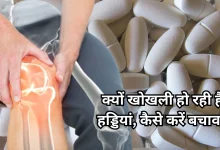 Photo of कैल्शियम की गोलियां खाने के बाद भी क्यों नहीं जाता हड्डियों का दर्द, यहां जानें