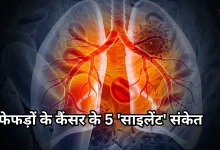 Photo of तीन हफ्ते से ज्यादा की खांसी को न करें इग्नोर, हो सकता है फेफड़ों के कैंसर का संकेत