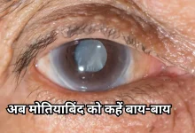 Photo of आंखों के लिए वरदान हैं ये सुपरफूड्स और आसान टिप्स, मोतियाबिंद भी नहीं होगा