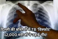 Photo of दिल्ली में चला टीबी जांच अभियान, पोर्टेबल X-ray मशीन का कमाल, बस्तियों में मिले हजारों मरीज
