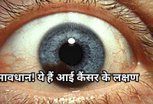 Photo of सामान्य थकान समझ कर आंखों के धुंधलेपन को न करें इग्नोर, हो सकती है बड़ी बीमारी की वजह