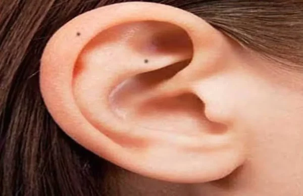 mole on the ear
