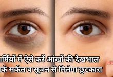 Photo of आंखों की सूजन और डार्क सर्कल से हैं परेशान, अपनाएं ये खास घरेलू उपाय