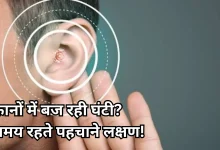 Photo of Hearing Loss: कम हो रही है सुनने की क्षमता, इन शुरुआती लक्षणों को न करें इग्नोर