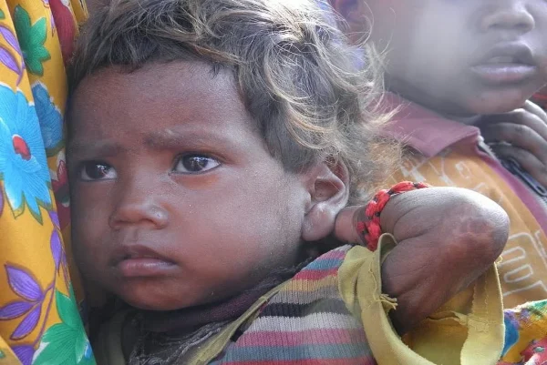 India in serious health crisis