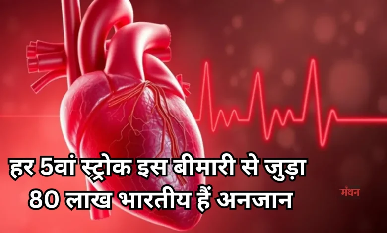 Atrial Fibrillation
