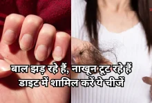 Photo of हेल्थ टिप्स: डाइट में शामिल करें ये 5 बायोटिन फूड्स, मजबूत होंगे बाल और नाखून
