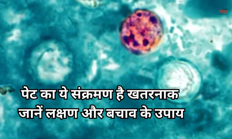 Cyclospora Infection