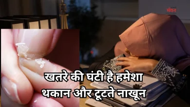 Photo of सोने के बाद भी लगी रहती है नींद, टूटते हैं नाखून, कहीं पोषक तत्व की कमी तो नहीं?