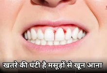 Photo of मसूड़ों से खून आना, न करें नजरअंदाज, दिल की सेहत से है सीधा कनेक्शन