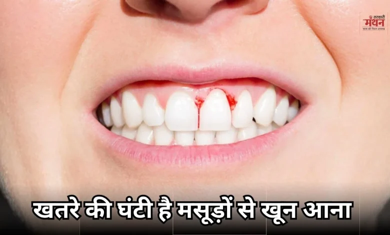 Bleeding gums are a warning sign