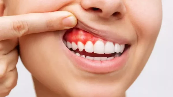 Bleeding gums are a warning sign