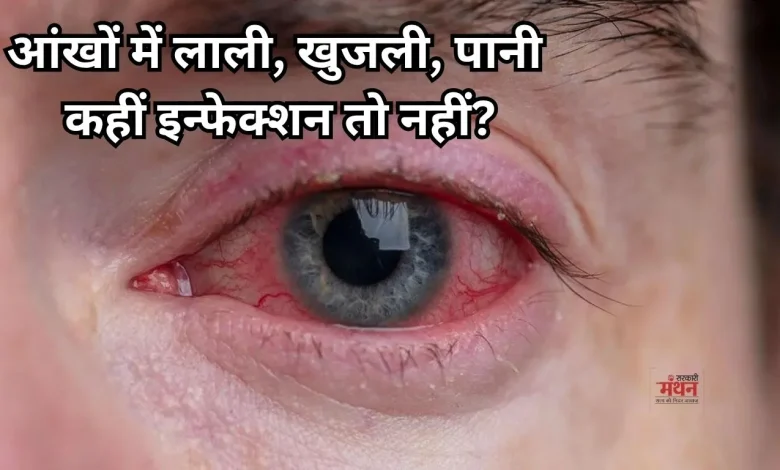 Monsoon Eye Infection