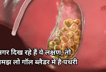 Photo of Gallbladder Stones: पित्त की थैली में कैसे बनती है पथरी? जानें लक्षण और बचाव के उपाय