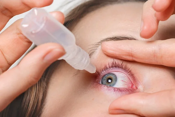 Monsoon Eye Infection