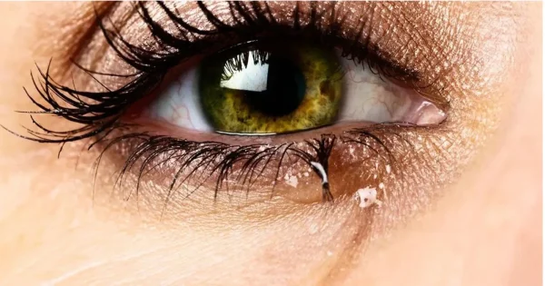 Monsoon Eye Infection c