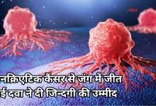 Photo of अब नहीं होगी पैनक्रिएटिक कैंसर से किसी की मौत, नई दवा को मिली FDA की मंजूरी