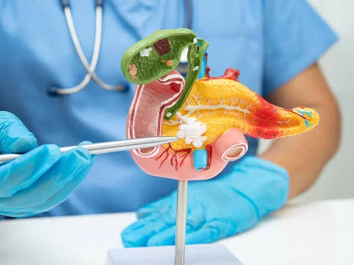 Pancreatic Cancer