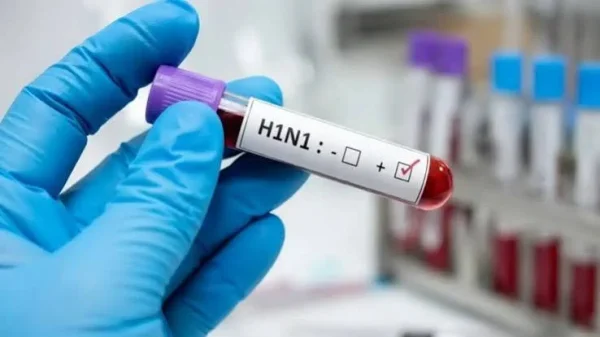 SwineFlu
