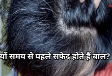 Photo of क्या सफेद बाल फिर से काले हो सकते हैं? जानिए क्या कहते हैं डर्मेटोलॉजिस्ट