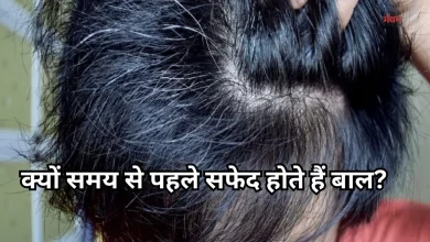 Photo of क्या सफेद बाल फिर से काले हो सकते हैं? जानिए क्या कहते हैं डर्मेटोलॉजिस्ट