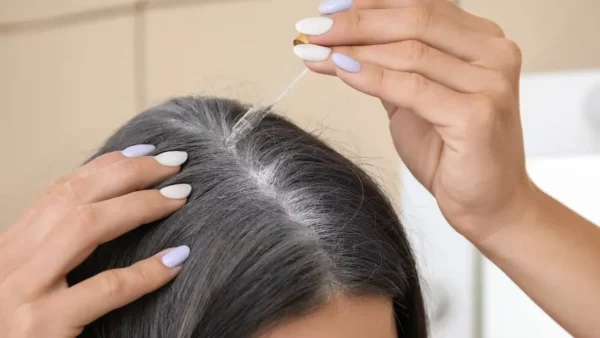 white hair