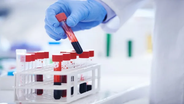New blood group