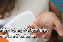 Photo of तनाव और एंजाइटी से भी झड़ सकते हैं बाल, डर्मेटोलॉजिस्ट ने बताई असली वजह