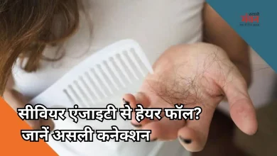 Photo of तनाव और एंजाइटी से भी झड़ सकते हैं बाल, डर्मेटोलॉजिस्ट ने बताई असली वजह