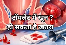 Photo of टॉयलेट में खून आना बवासीर ही नहीं, इस गंभीर बीमारी का भी हो सकता है संकेत