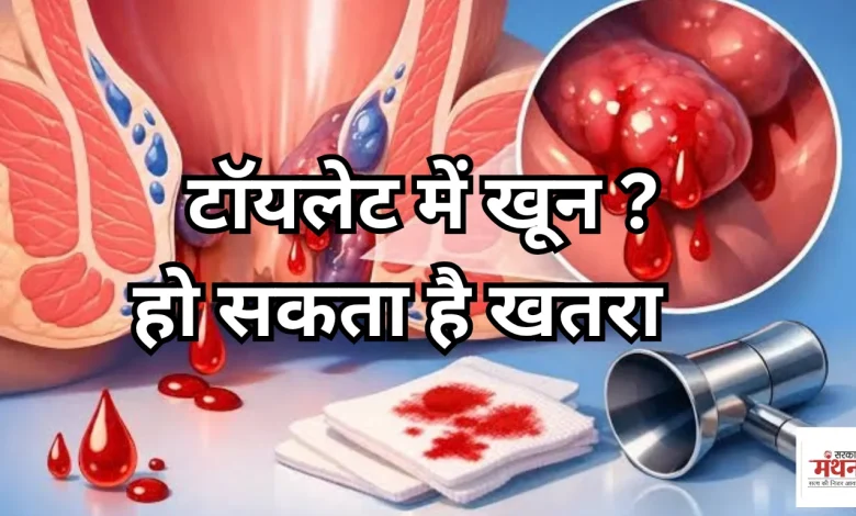 Colon Cancer