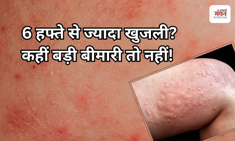 Itching and Rashes